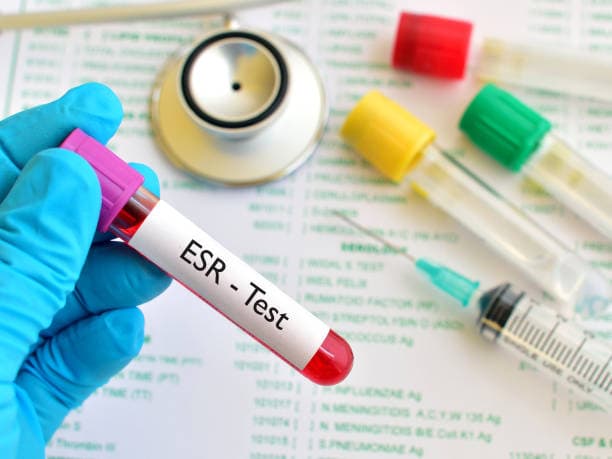 ESR